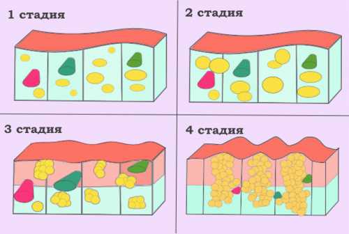 как определить пол ребёнка по животу: народные примеры, поверья